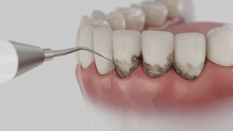 Reliable Tooth Extraction contractor in Hamilton City, CA by Smile Center Dentistry